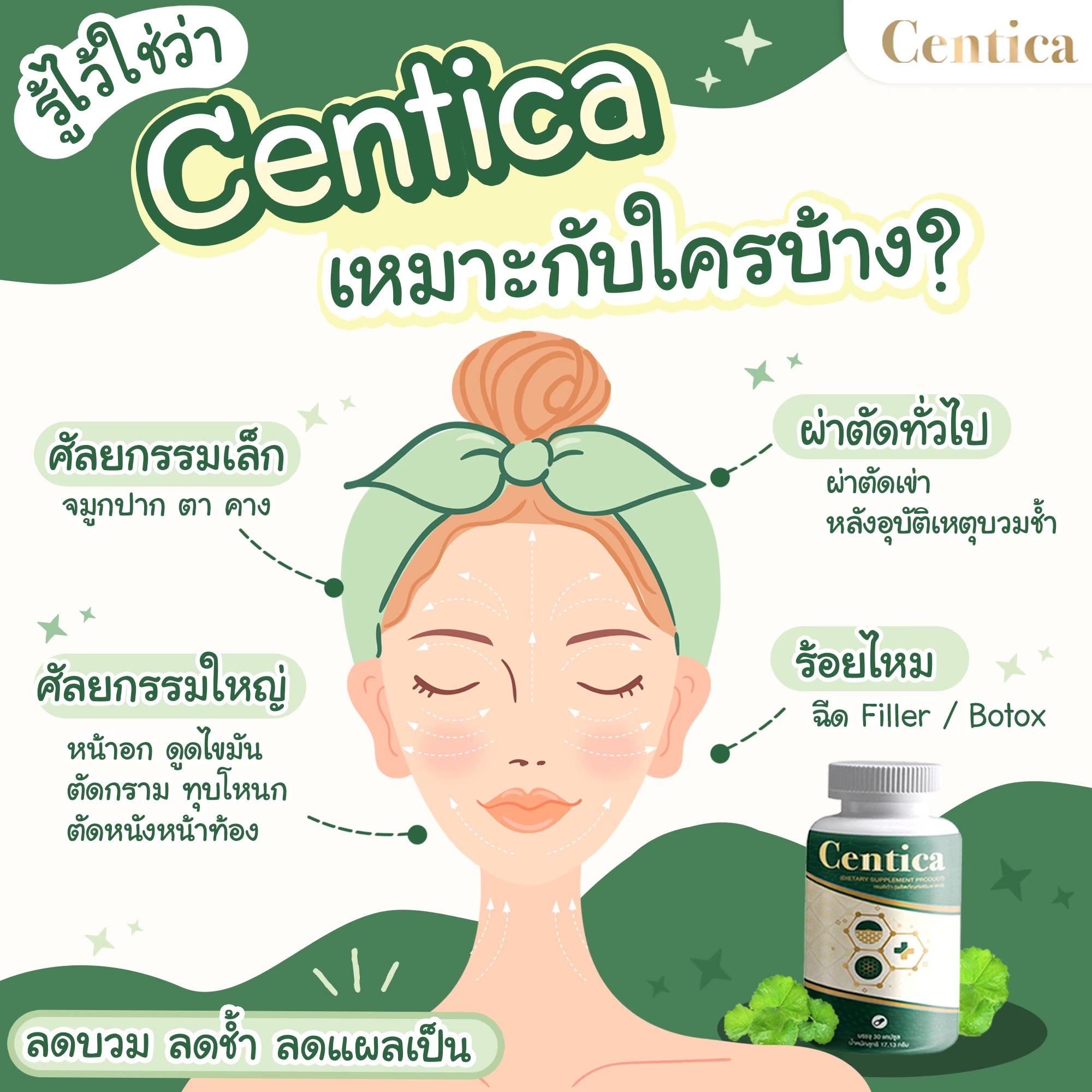 รูปภาพรายละเอียดของ Centica อาหารเสริมเพื่อการฟื้นฟู ลดบวมช้ำ ลดการเกิดรอยแผลเป็นหลังศัลยกรรม 2 กระปุก