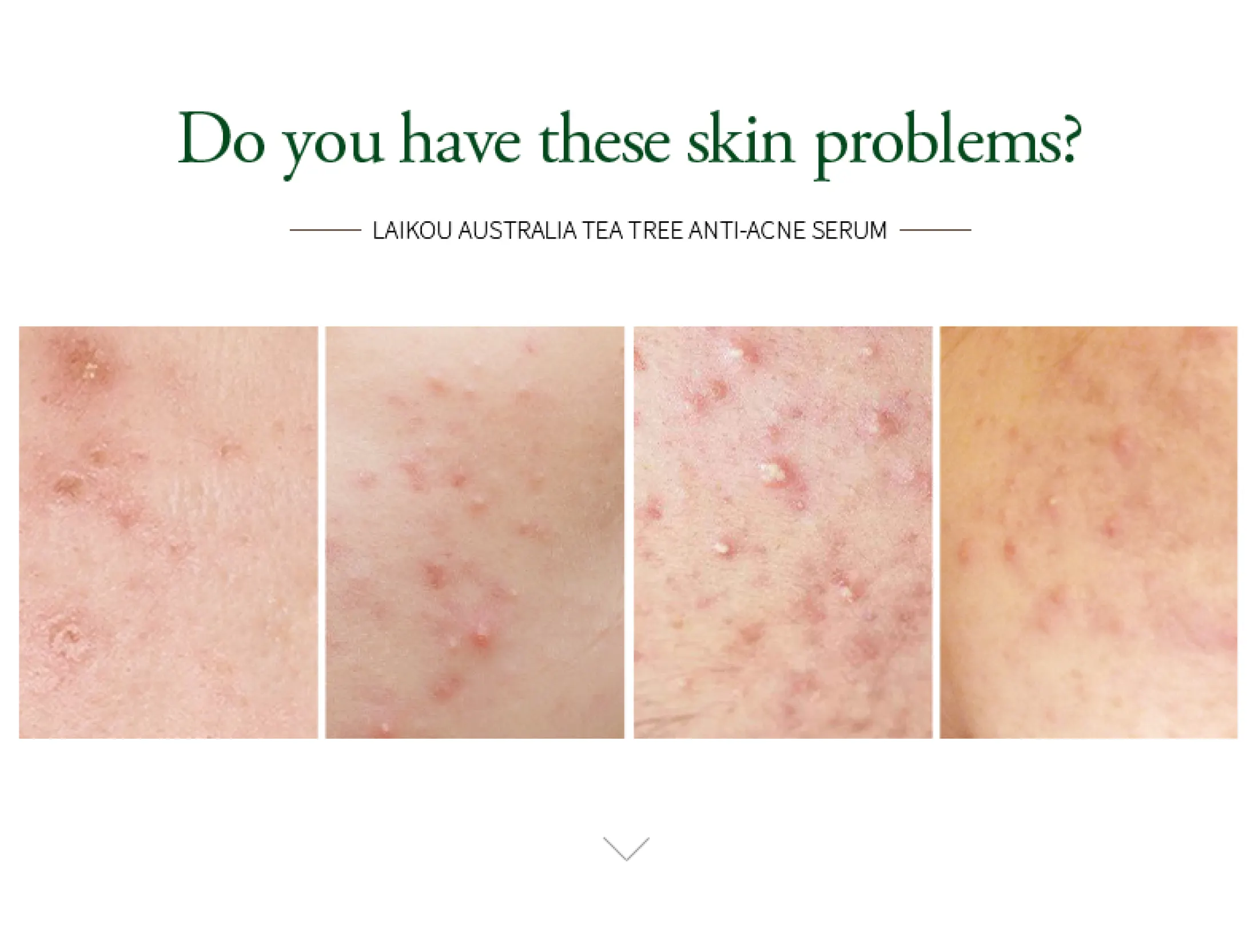 laikou tea tree serum